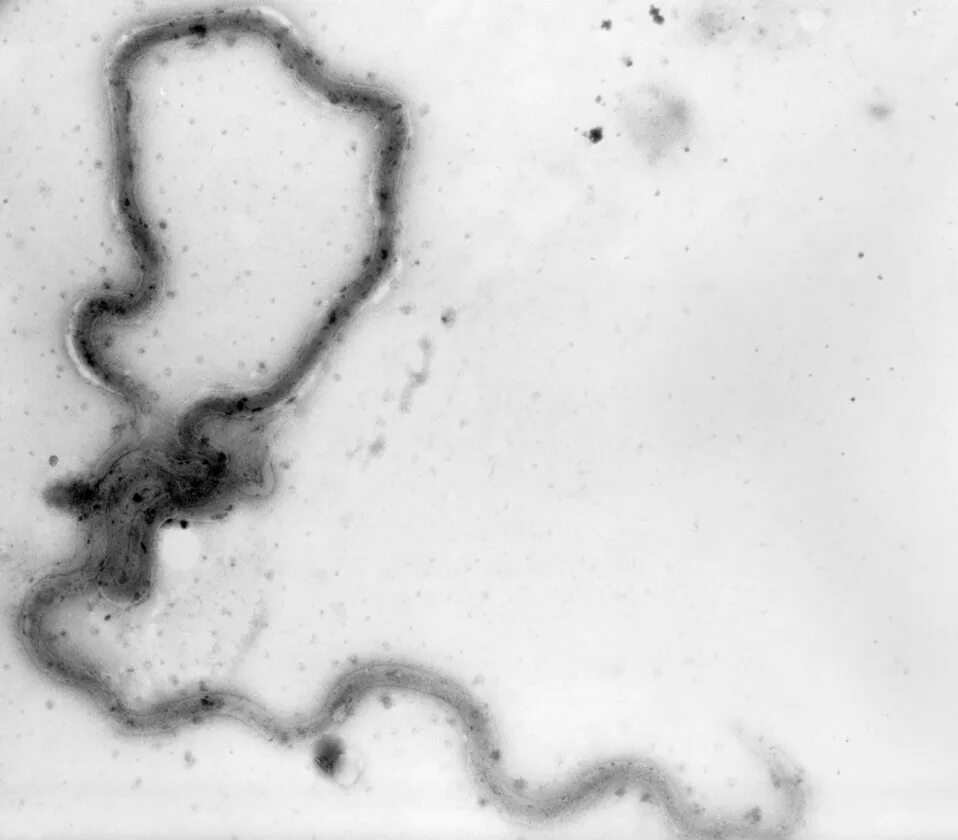 бледная трепонема что это за бактерия