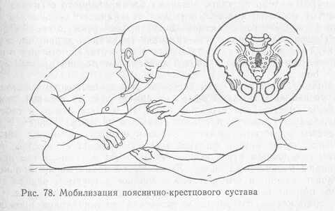 Как вставить позвонки на место