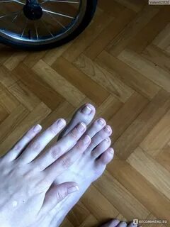 Почему скручиваются пальцы