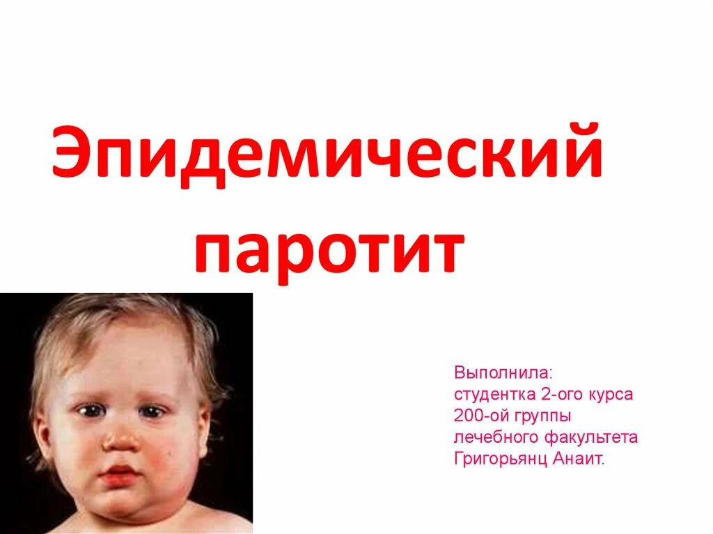 Паротит a b c. Эпидемический паротит. клинические проявления паротита. острый эпидемический паротит.