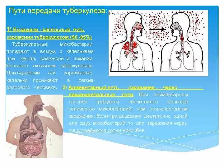 Где заражаются туберкулезом