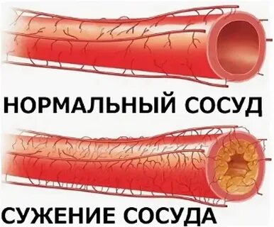 Сужаться форум