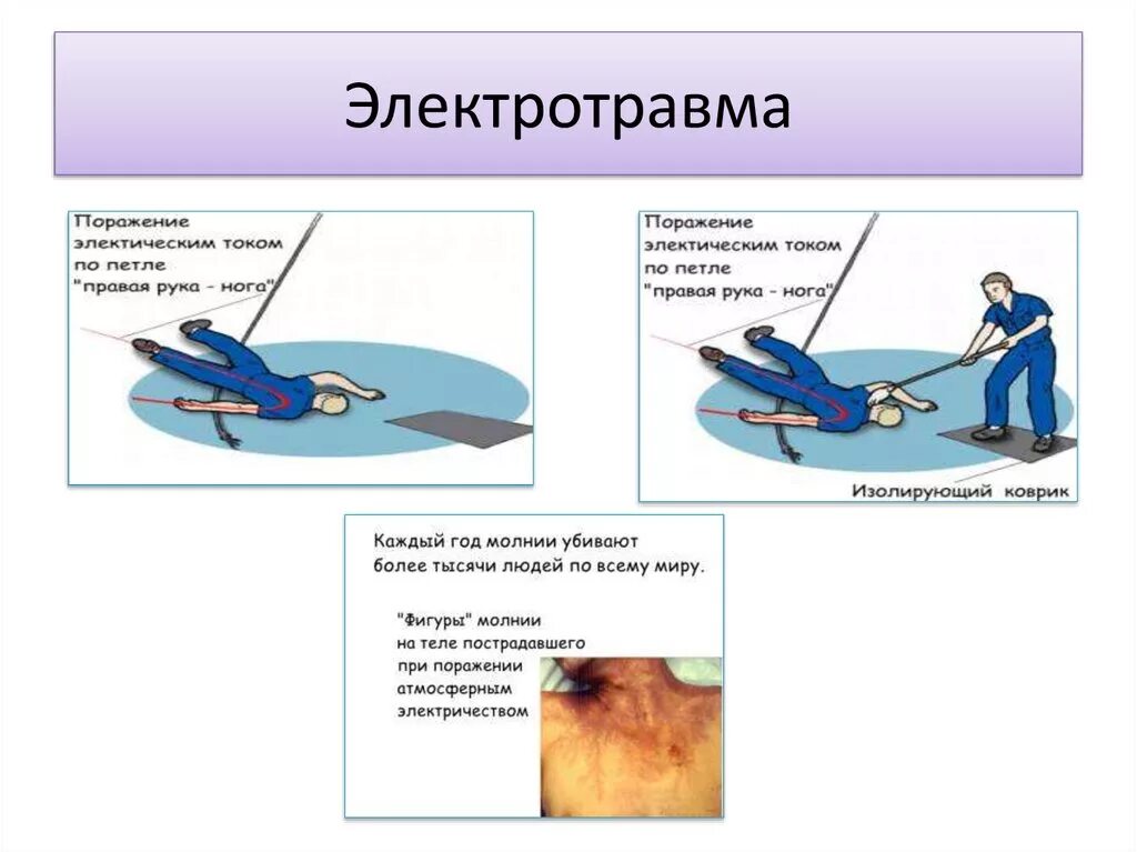 Поражения при электротравме. Электротравма петля тока. Петли при электротравмах.