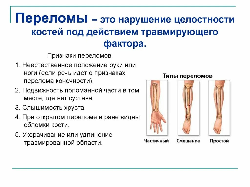 Перелом кости может быть каким. Характеристика переломов костей. Симптоматика перелома кости. Переломы костей презентация.