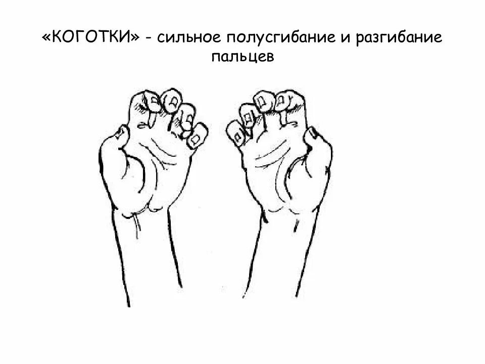 Упражнения для пальцев. Пальчиковая гимнастика. Упражнения для развития пальцев рук. Схемы пальчиковых игр.