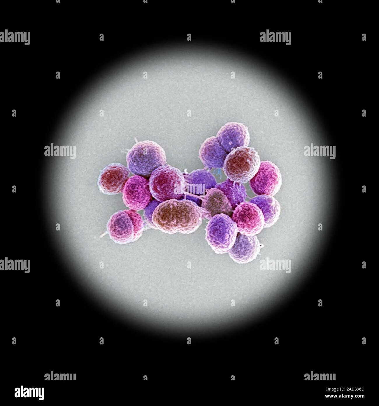Enterococcus l3. Энтерококки бактерии. энтерококки микробиология. enterococcus faecalis под микроскопом. бактерии рода enterococcus.
