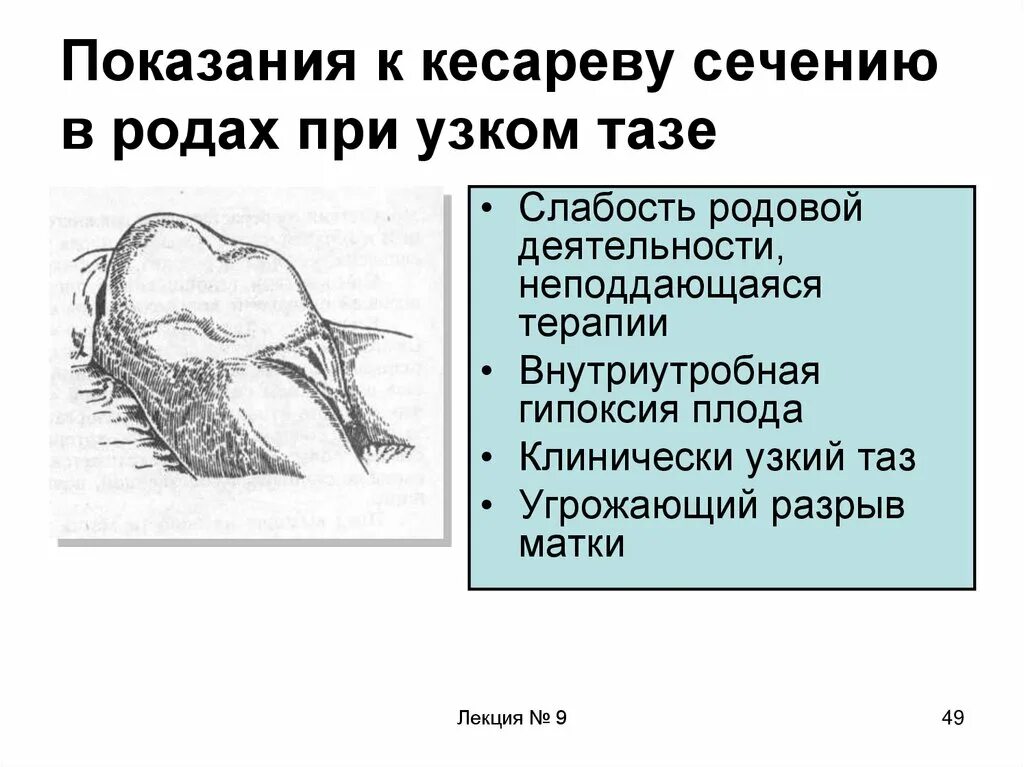 Зачем пришел в род. Кесарево сечение показания в родах. Показания к кесареву сечению при узком тазе. Кесарево сечение протокол операции пример.