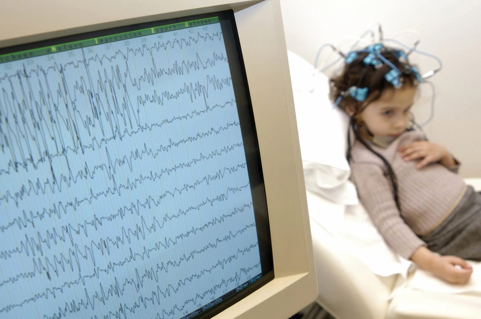 Доктор ээг. ЭЭГ головного мозга ребенку. Электроэнцефалография у детей. ЭЭГ детям с ДЦП.