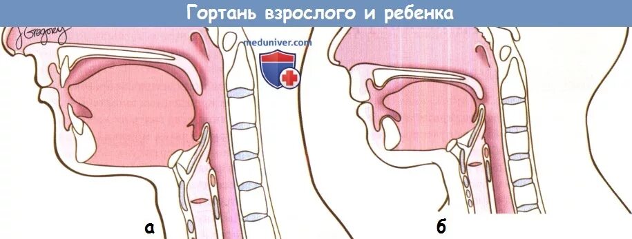 Детская гортань. Гортань ребенка и взрослого.