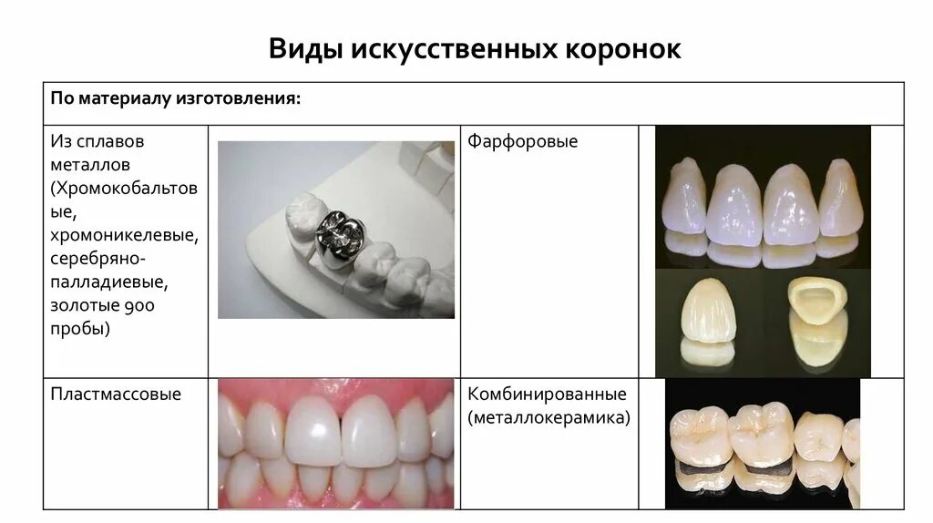 Классификация коронок. Искусственные коронки классификация по назначению. Классификация коронок по конструкции. Классификация металлокерамических коронок.