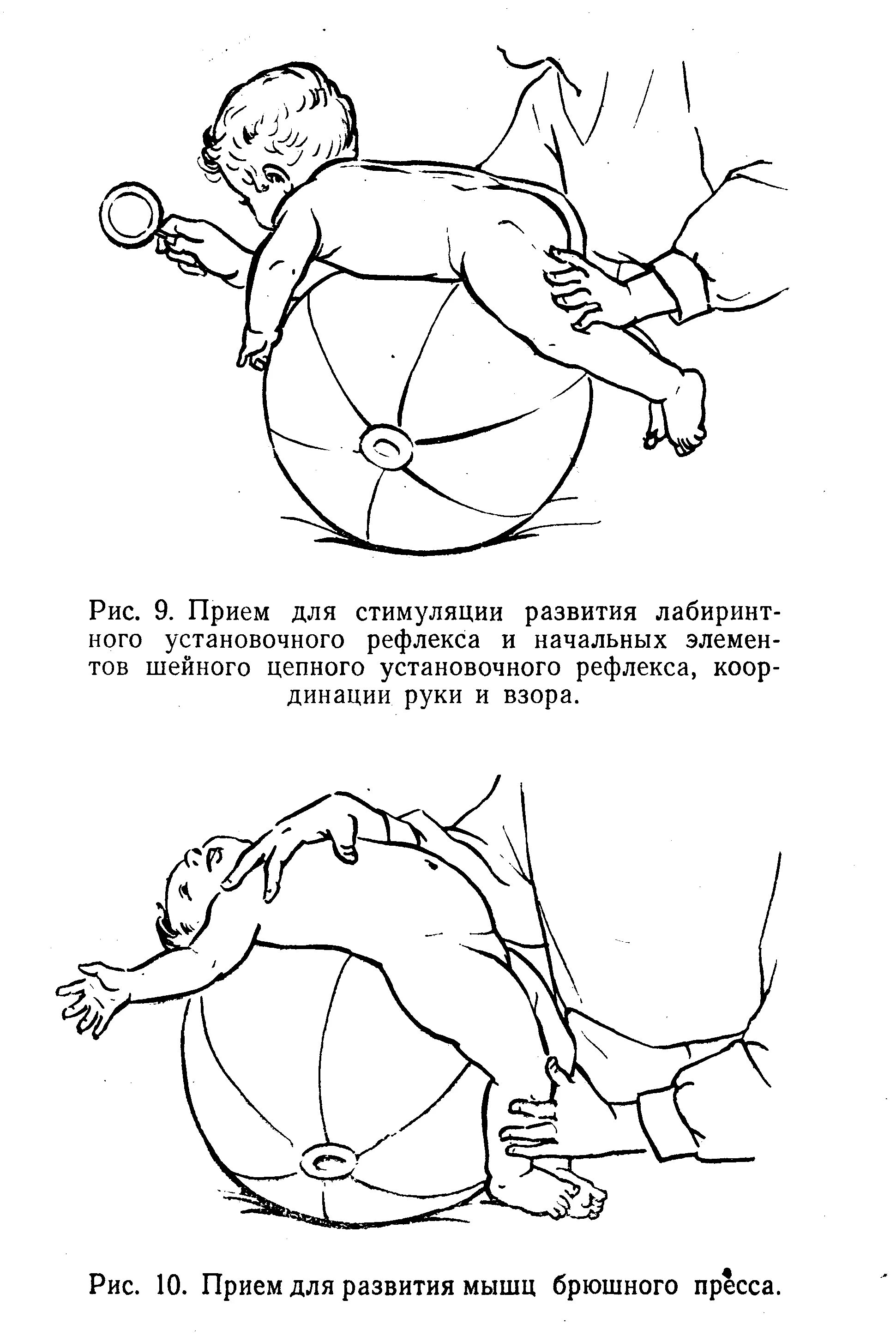 Рефлекс Ландау у детей. Рефлекс Ландау у новорожденных верхний и Нижний. Методика массажа при ДЦП. Методика ЛФК при ДЦП.