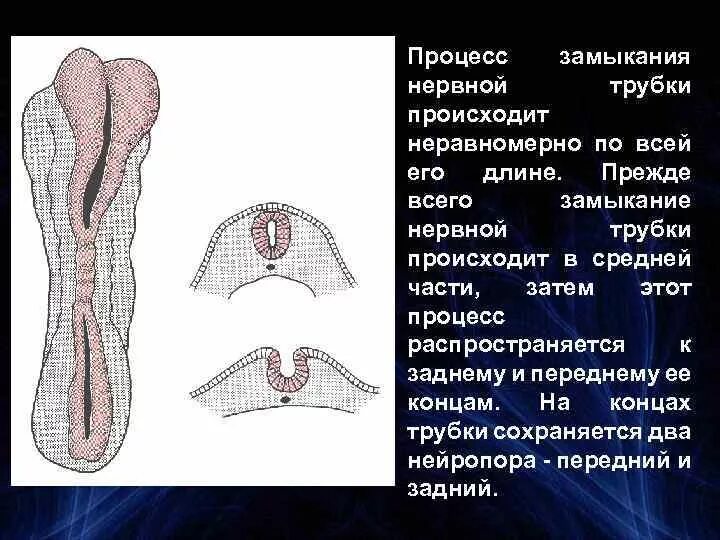 Блоковый нерв (iv пара черепных нервов). Причины короткого замыкания. Травматические повреждения периферических нервов. Кароткой замекании. Замыкание нервов.