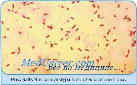 Сальмонелла мазок