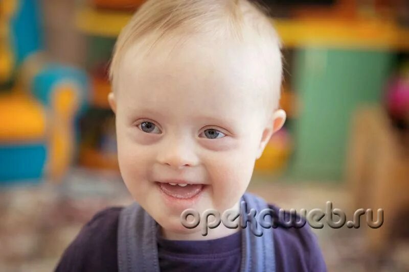 дети дауны 1 год