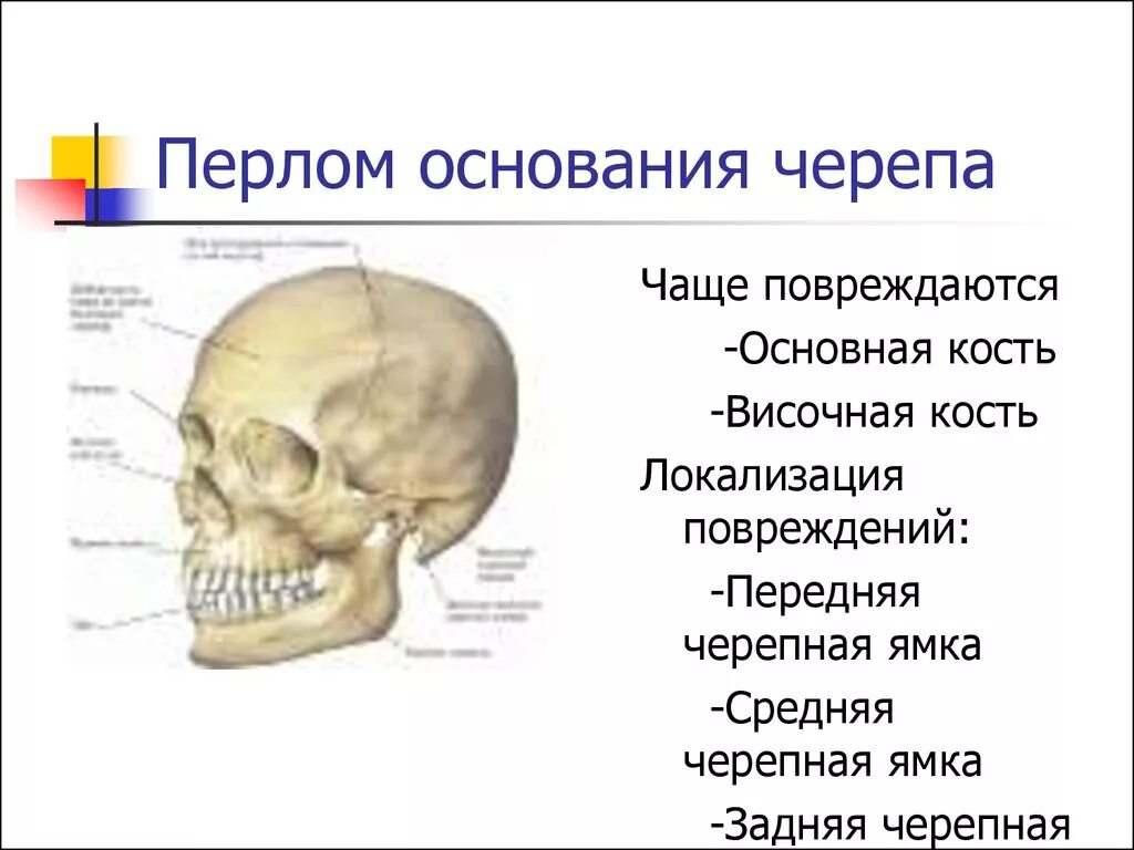 Граница свода и основания. Височная кость кость черепа. кости основания черепа где находится. слабая кость черепа человека. кости основания и свода черепа перечислить.
