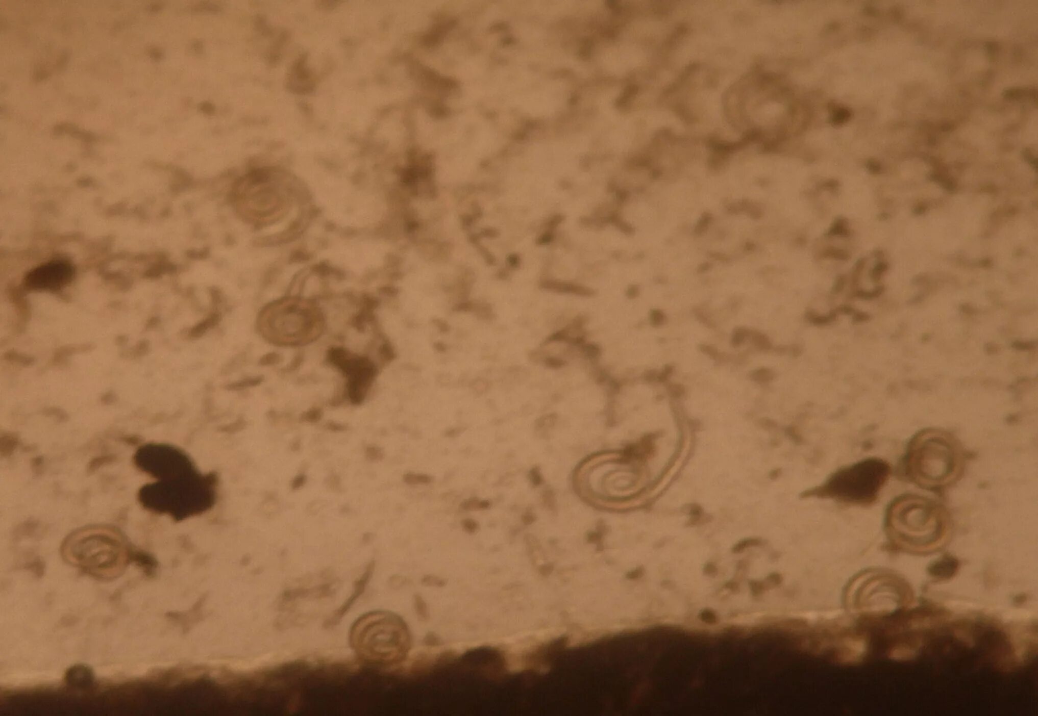 A comparative survey of the prevalence of human parasites found in fresh vegetab