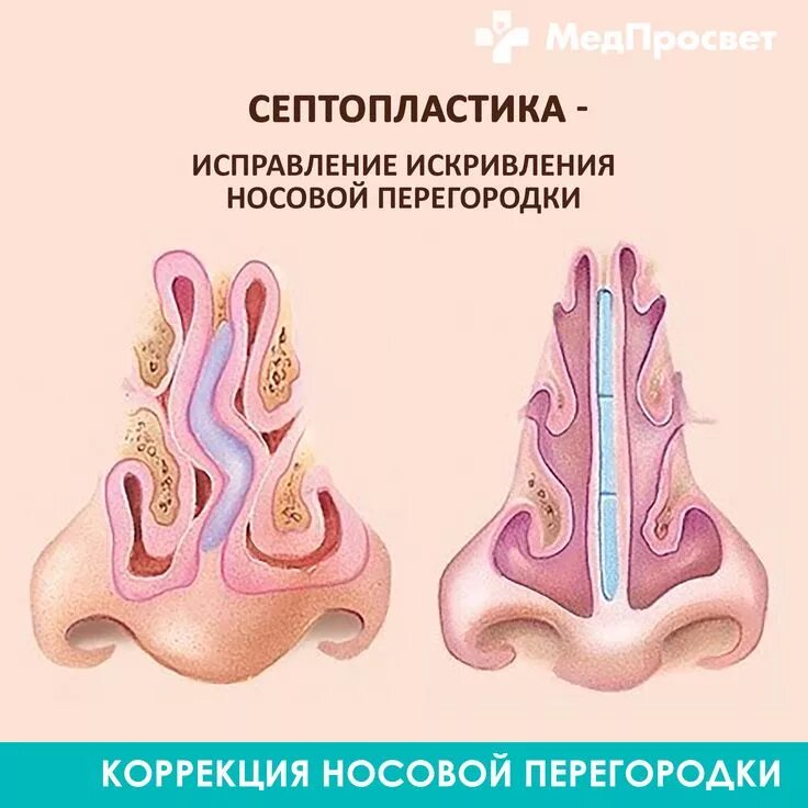 Компьютерно-томографическая анатомия лор-органов, страница 8