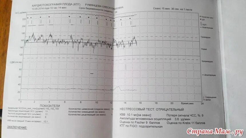 Подозрительное ктг. Нестрессовый тест ктг. оценка по ктг figo- подозрительная. кардиотокография нестрессовый тест. нестрессовый тест положительный на ктг.