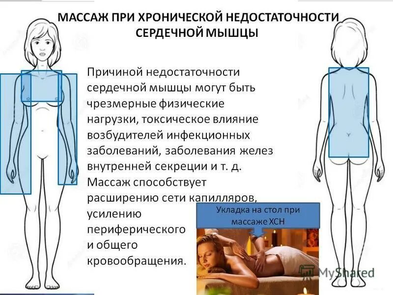 Лечебная физкультура при эмфиземе. Радикулит симптомы. Методика массажа при заболевании жкт. Массаж при болезнях сердца. Массаж грудной клетки при пневмонии.