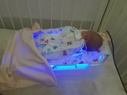 Сколько новорожденный лежит под лампой