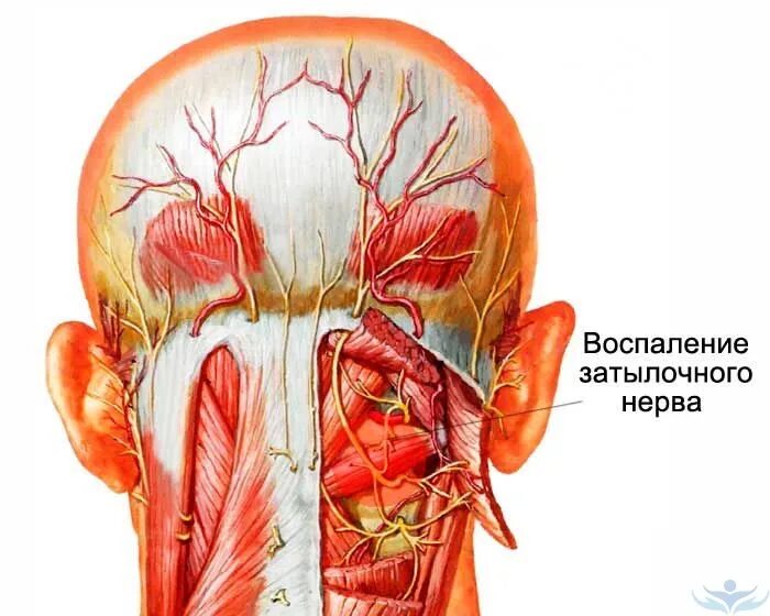 Невралгия затылочного нерва симптомы. Большой затылочный нерв анатомия. Подзатылочный нерв анатомия. Невралгия затылочного нерва нерва.