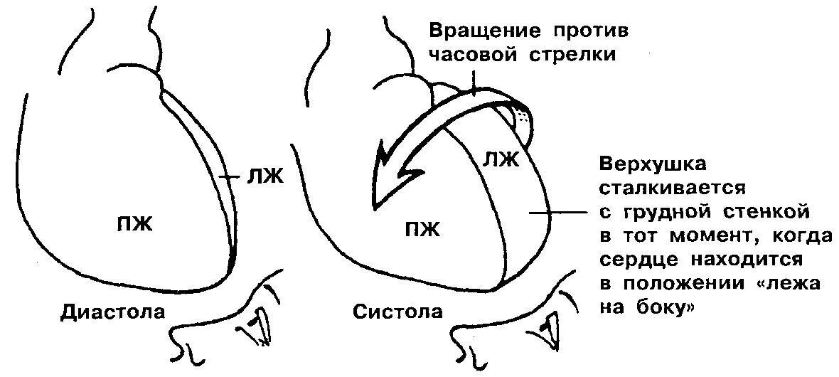 Повороты сердца на ЭКГ вокруг продольной оси. Поворот сердца против часовой стрелки. Вращение против часовой стрелки. Поворот сердца вокруг продольной оси. Сердце против часовой стрелки