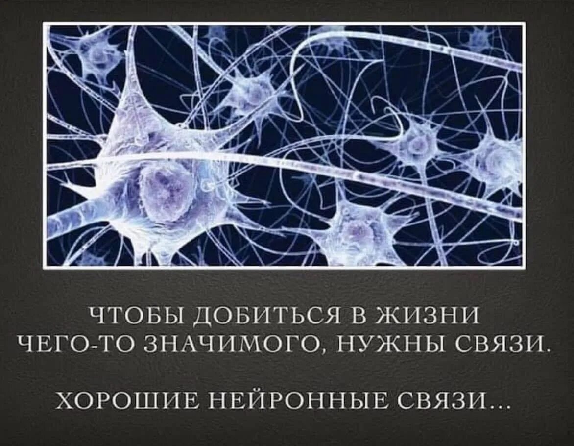Самые нужные связи. Нейронные связи. Нужны хорошие нейронные связи. Новые нейронные связи. Как создаются новые нейронные связи.