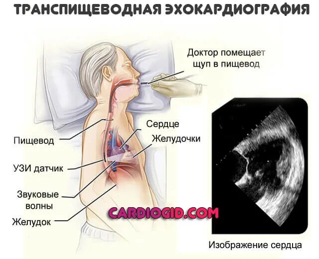 Эхо кардиография. Чреспищеводная ЭХОКГ датчик. Ультразвуковое исследование сердца трансторакальное. Чреспищеводная эхокардиография (ЧПЭХОКГ). Эхокардиография через пищевод.