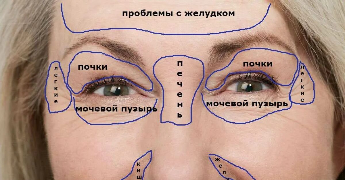 Болят брови и лоб. Физиогномика межбровная складка. Прыщи на лбу между бровями.