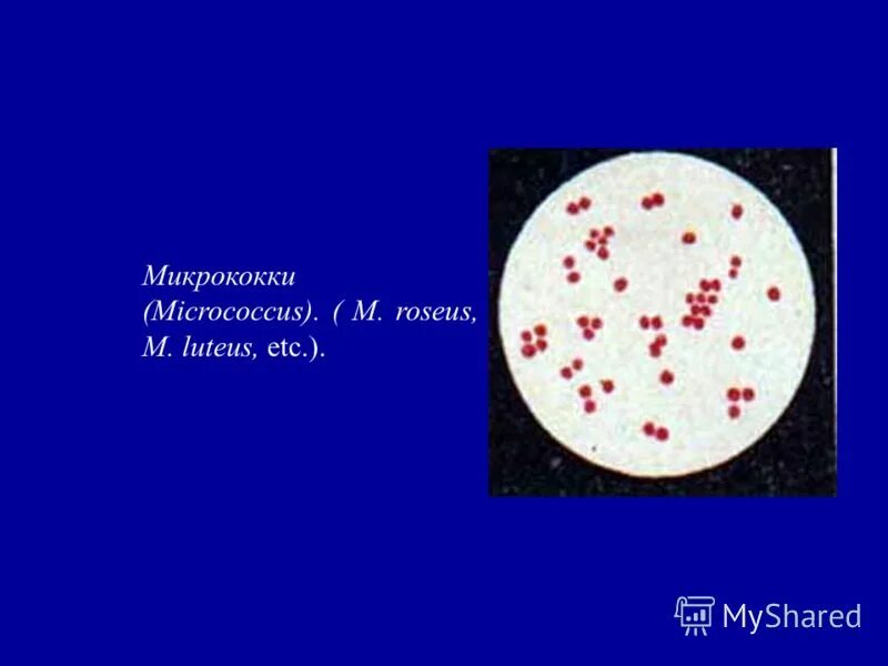Микрококки лютеус. Микрококки. Микрококки и стафилококки. Микрококки. Микрококки.