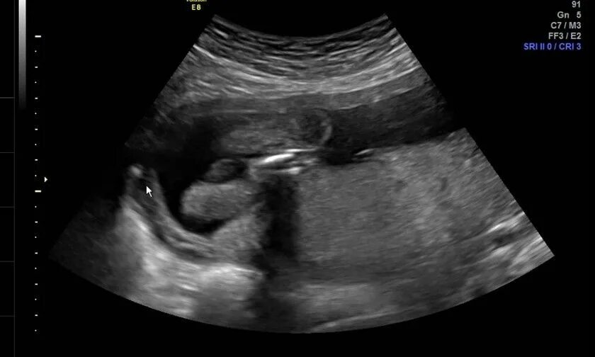 28-я неделька))) форум Babyblog
