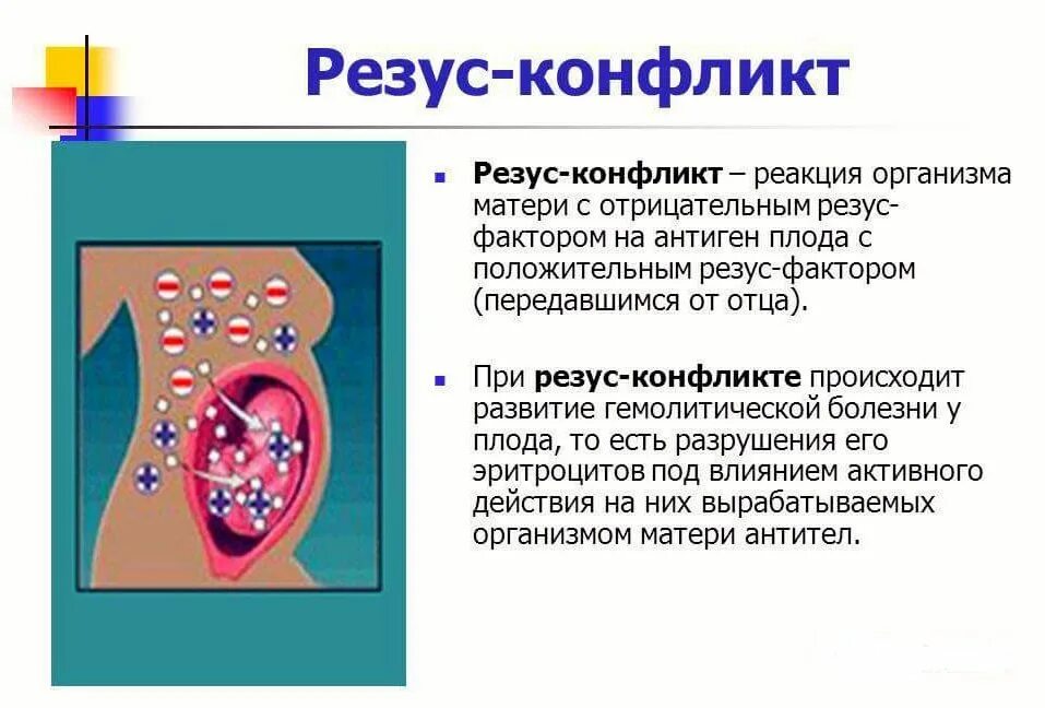 Конфликт резус факторов при беременности