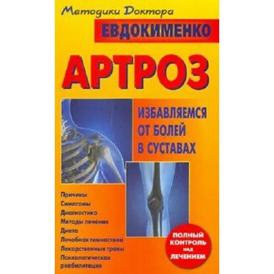 Евдокименко гастрит. Доктор Евдокименко. Евдокименко книги. Книга Евдокименко артроз.