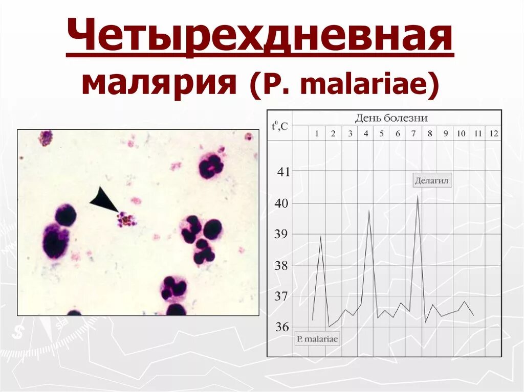 Малярийная кома чаще наблюдается при малярии. Лихорадка при малярии 4 дневная. Трехдневная малярия лихорадка. Температурная кривая при четырехдневной малярии. Малярия симптомы возбудитель.