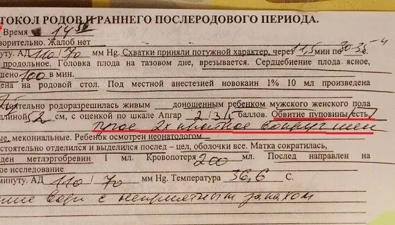 40 недель а родов нет форум. Петли пуповины в проекции шеи плода. Пуповина вокруг шеи плода. Ребенок в пуповине замотается. Петли пуповины в проекции шеи плода визуализируется.