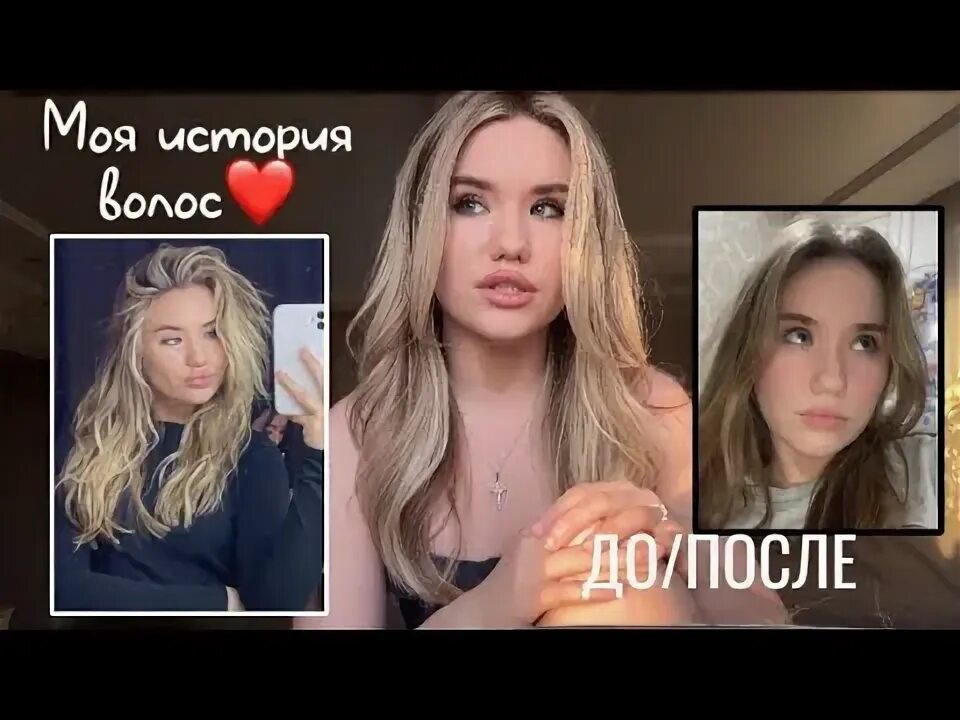 Выпадают волосы после коронавируса. Растет подшерсток на голове. Волосы после короны. Миноксидил для волос для женщин. Волосы после короны.