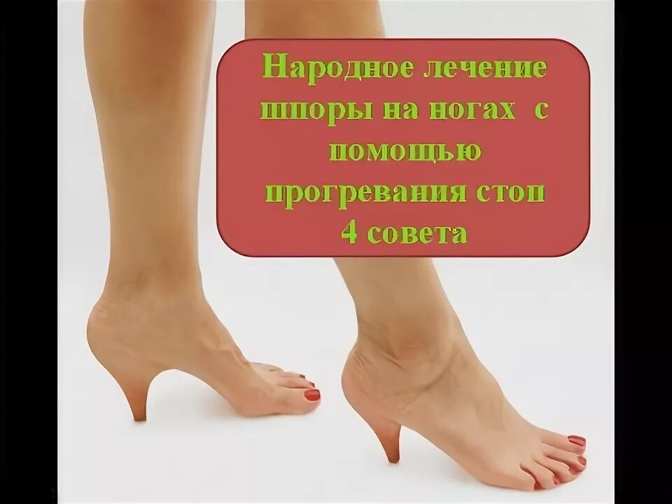 Лечение шпоры. Что бывает на пятках