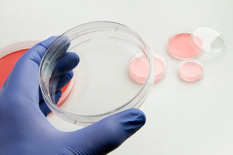 10см Petri dish Thermo Fisher. Мокрота в чашке Петри. Чашка Петри лаборатория. Чашка Петри с культурой. Чашка петри бумага