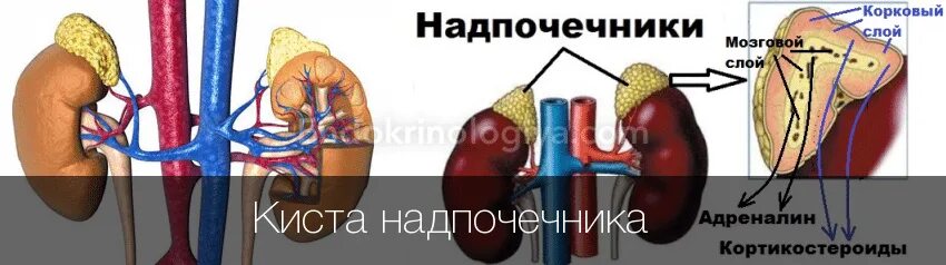 Киста надпочечника симптомы лечение. Надпочечники кисты рисунок. Киста надпочечника симптомы лечение. Кт мрт аденома надпочечника. Надпочечники железа строение.
