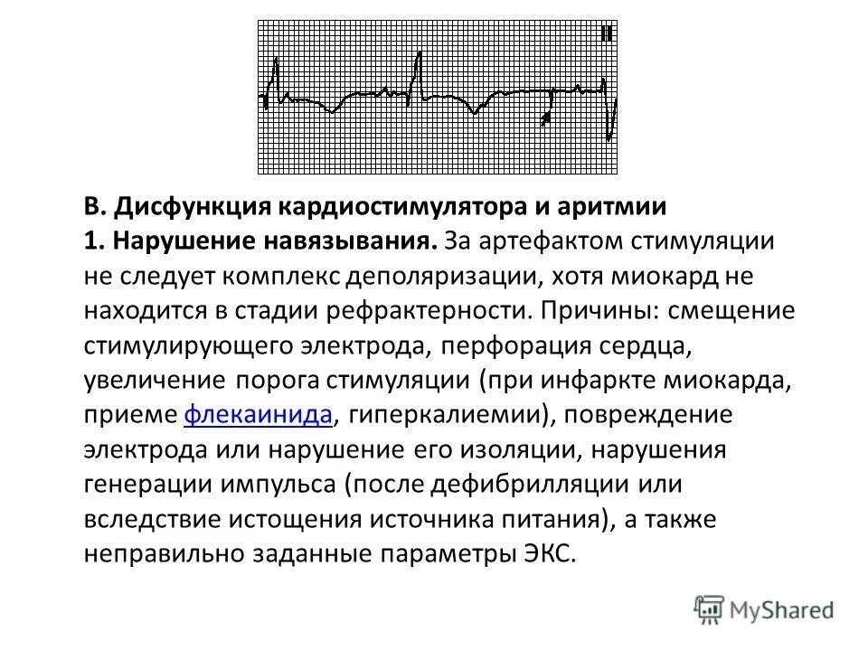Частота сердечных сокращений. Корригированный интервал qt. Интервал сердечных сокращений. Частота серцевих скорочень. Чсс.