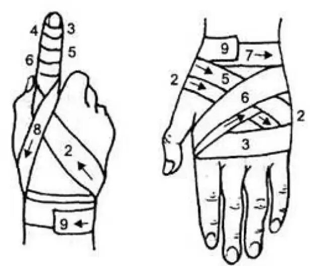Повязка на руку схема. Колосовидная повязка на палец. Колосовидная повязка на 1 палец. Перевязка кисти эластичным бинтом. Схема бинтования пальца на руке.