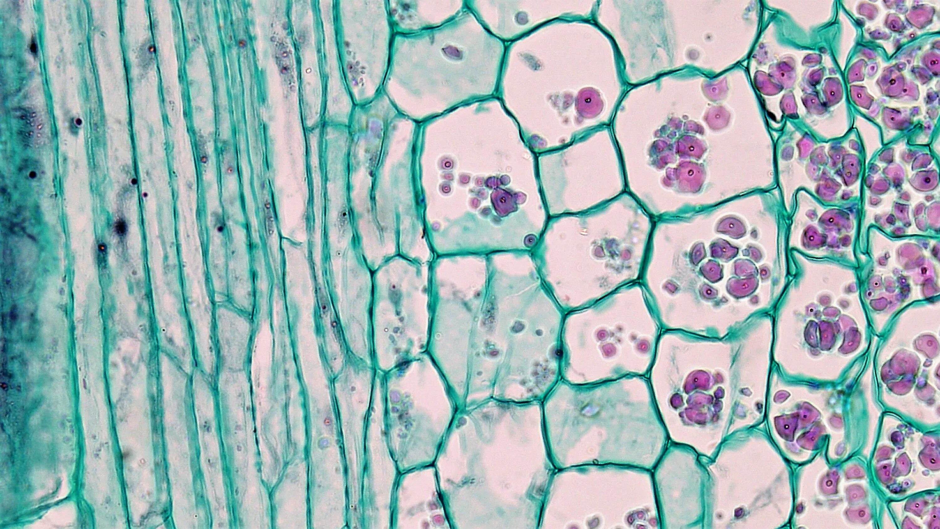 Три группы клеток. Parenchyma Cells. Паренхимные клетки. Рахитическая ар. Клетка.