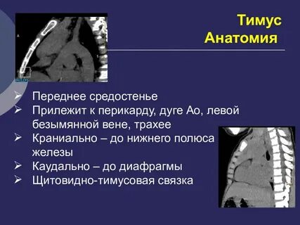 Переднее средостение на кт