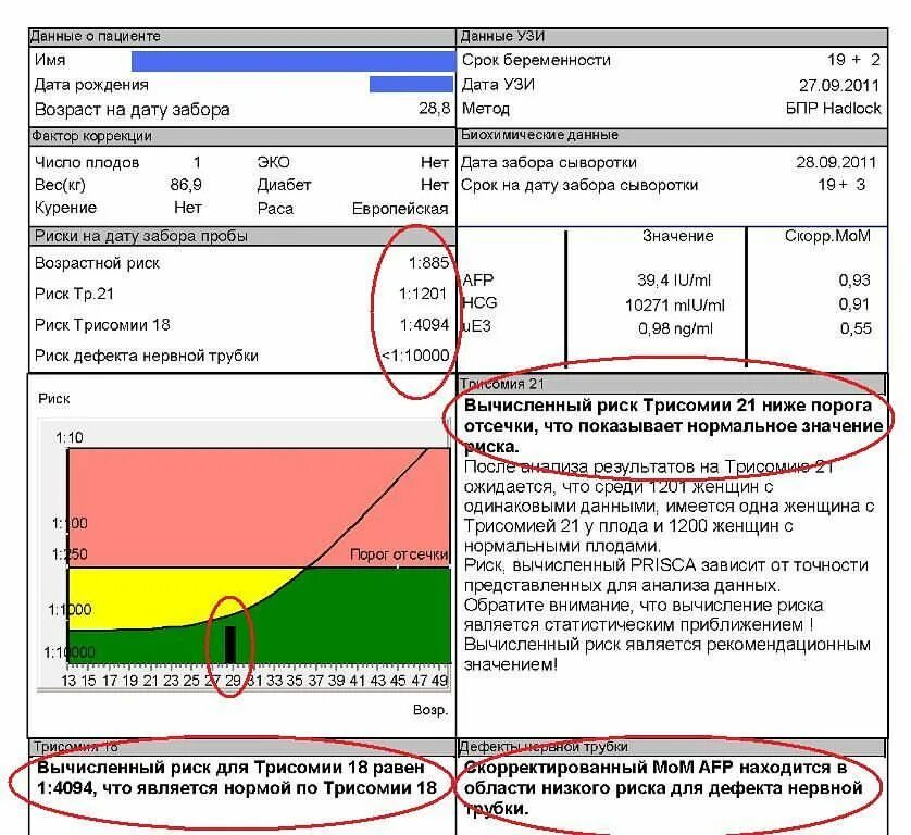 Двойной тест 1. Скрининговый тест на синдром Дауна при беременности расшифровка. Расшифровка скрининга 1 триместра трисомия. Двойной тест скрининг 1 триместра расшифровка. Трисомия 21 18 13 норма.
