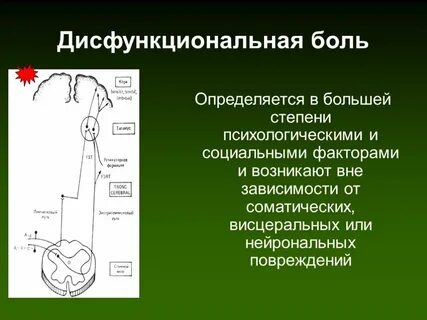 Главное отличие дисфункционального типа боли в том