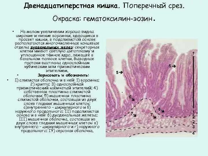 12 Перстная кишка гистология. Тонкая кишка гистология препарат. Стенка 12 перстной кишки гистология. Эпителий тонкой кишки гистология. Особенности слизистой оболочки кишечника