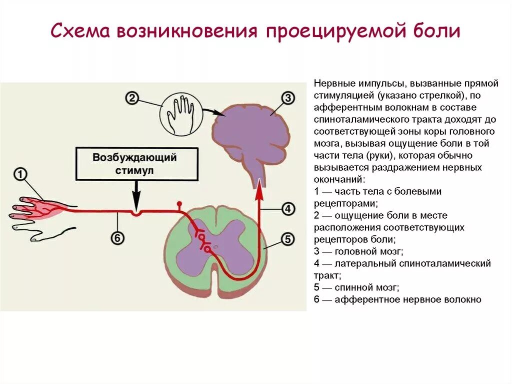 Путь передачи нервного импульса в мозг. Проецированная боль механизм развития. Схема формирования отраженной боли. Механизм проведения болевого импульса. Механизм формирования отраженной боли.