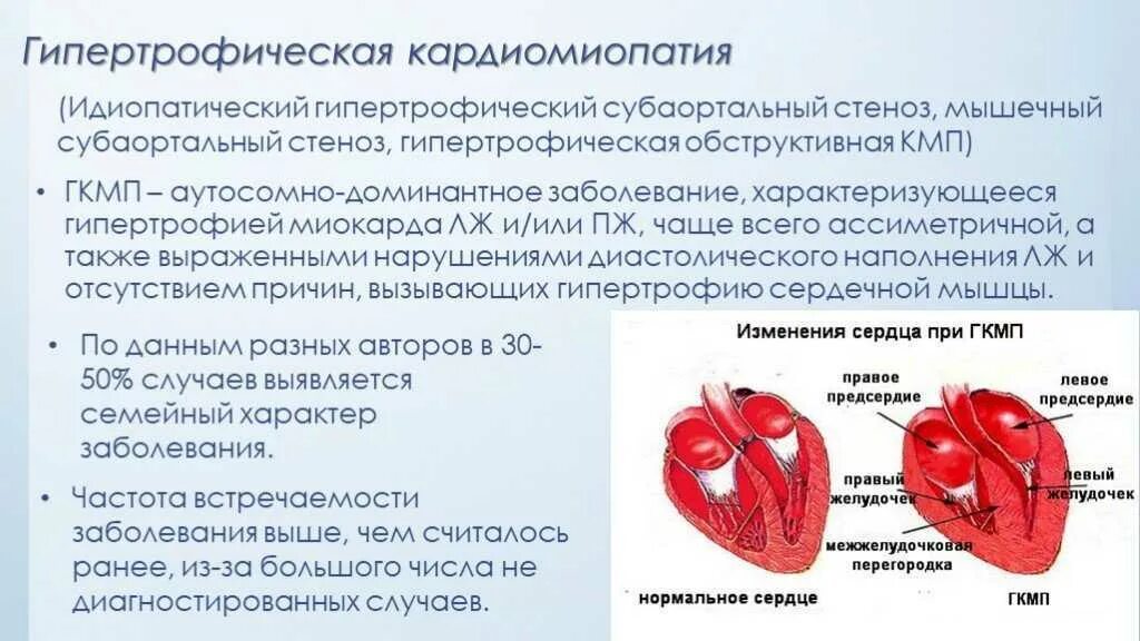 Изменения миокарда предсердий. Аускультация при гипертрофической кардиомиопатии. Симптомы гипертрофической кардиомиопатии. Гипертрофия кардиомиоцитов патогенез. Кардиомиопатия сердца что это такое.