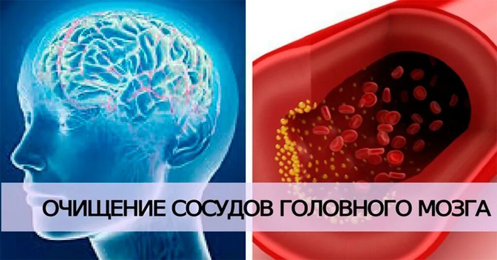 Вода очистит сосуды. Очищение сосудов головного. Очистка сосудов головного мозга.