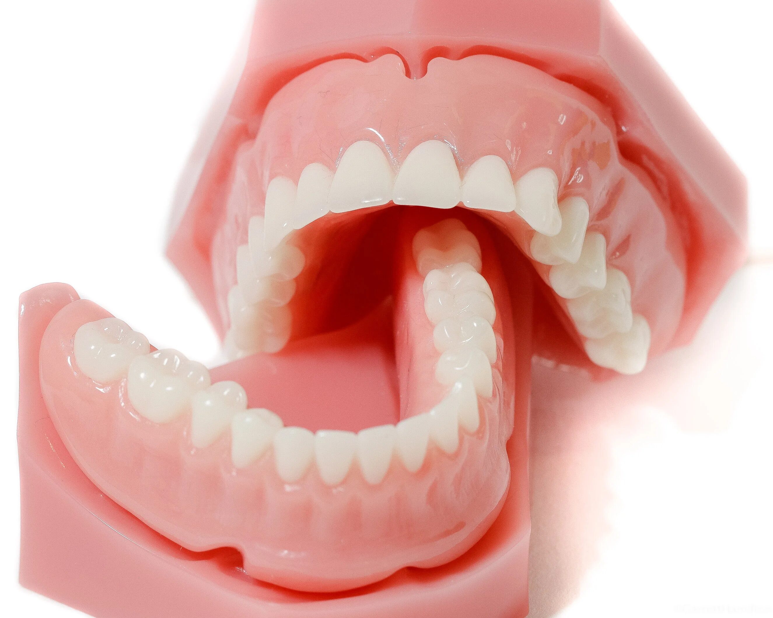 Зубные протезы нового поколения цена. Съемный протез (6-14 зубов) термо Джет.